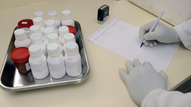 image for news Here's Why Bristol Myers Squibb (BMY) is a Strong Value Stock