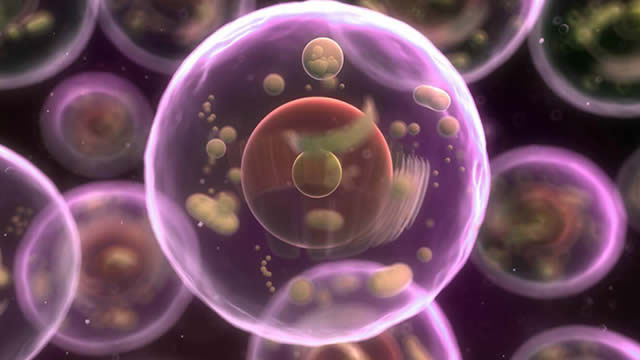 image for news RXRX Stock Up on Acquiring Full Rights to the Hypophosphatasia Program