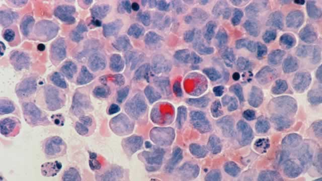 This Biotech's Cancer Portfolio Could End Its Rough Patch