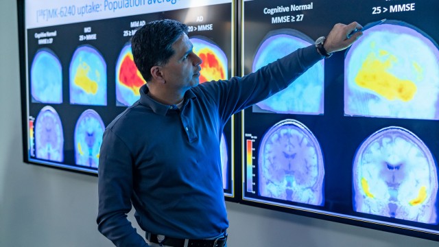 Alzheimer's patients retain the benefits of Leqembi even when they stop the drug, Eisai says