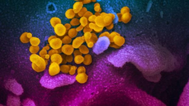 Cocrystal Pharma Stock Gains After Laying Out Plans To Launch Another COVID-19 Antiviral Candidate
